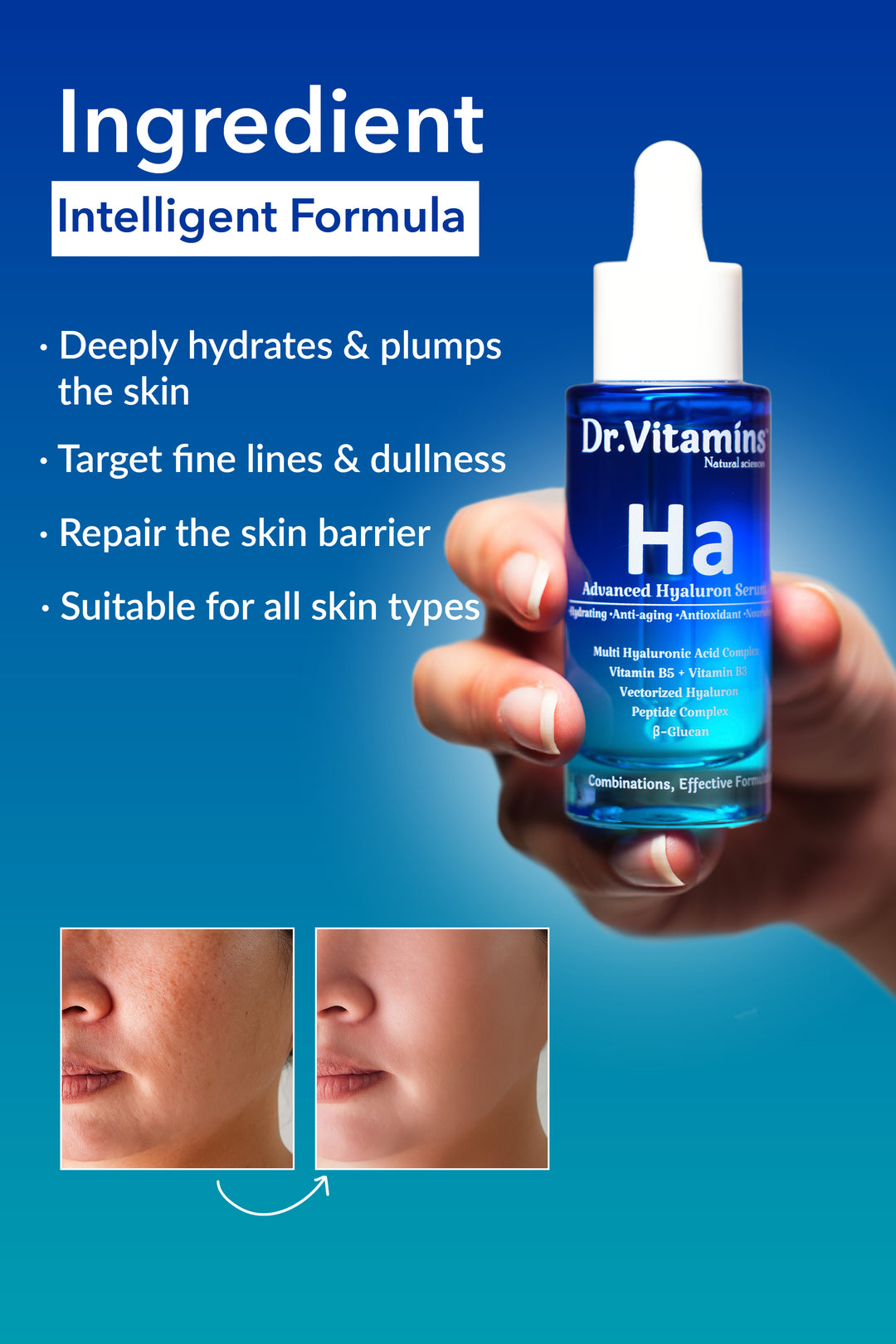 Advanced Hyaluron Serum